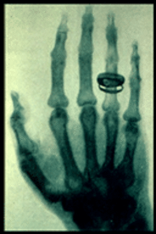 X-Ray's are discovered by William Roentgen