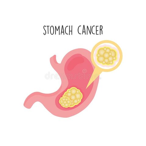 muerte de mi mamá *