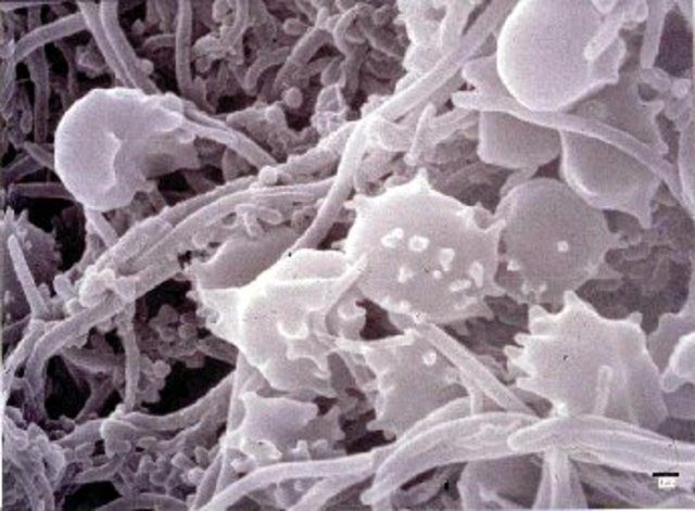 Bacteria is Discovered by Antony Van Leeuenhoek