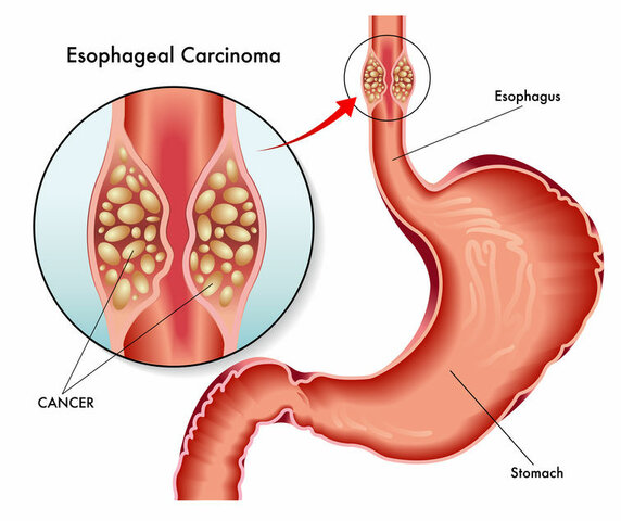 muerte de mi abuelo *