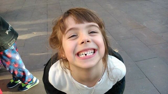 SE'M CAU LA MEVA PRIMERA DENT