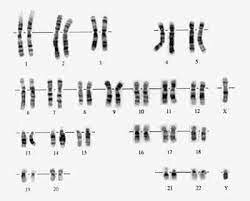 Primera terapia genética.