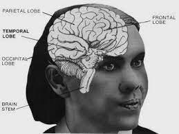 Accidente en la niñez Elena White