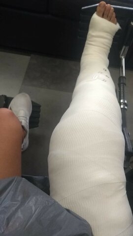 Me lesioné la rodilla en un partido