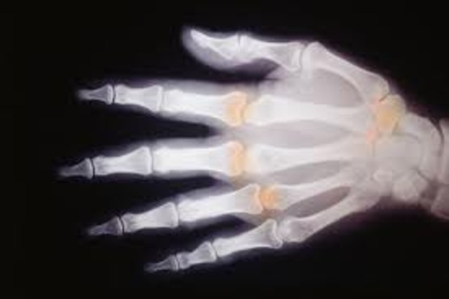 Wilhelm Roentgen discovered x-rays