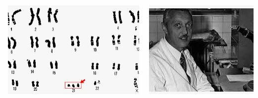 Jérôme Lejeune descubrió que el síndrome de Down