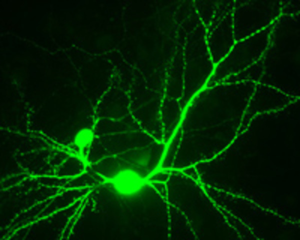 Using Stem Cell Technology to Make New Neurons