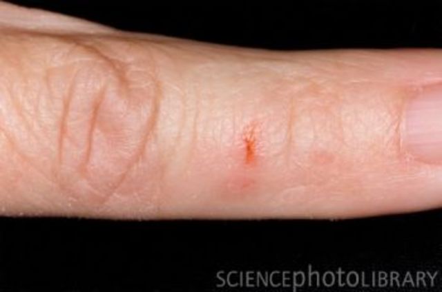 Algernon bit Charlie