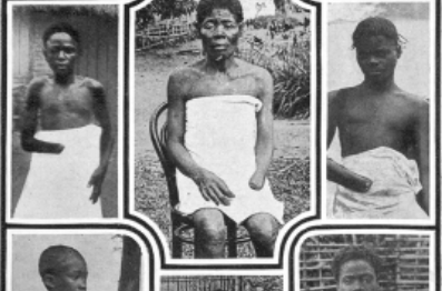 Belgium's Acquisitions