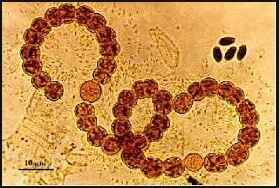 LA TEORÍA MICROBIANA