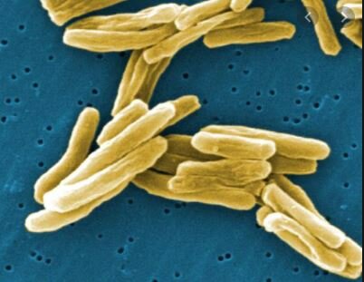 LA TEORÍA MICROBIANA