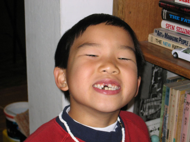 Cuando yo aba cuatro, yo perdí mi primero diente.