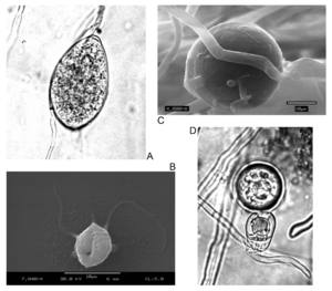 La teoría microbiana sin PASTEUR Y KOCH
