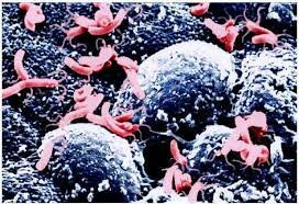 Barry Marshall y Robin Warren demuestran el papel de Helicobacter pylori en la úlcera de estómago.