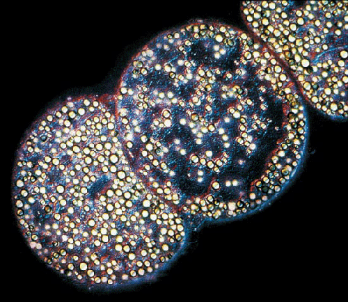 Se descubre la bacteria gigante Thiomargarita namibiensis