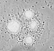 Secuenciación del genoma de Legionella pneumophila, el microorganismo productor de la enfermedad de los legionarios.