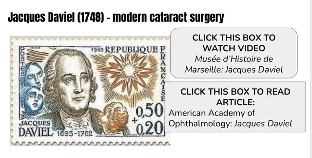 Jacques Daviel develops modern cataract surgery.