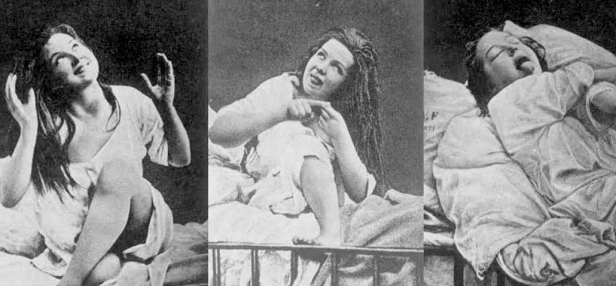 Iconografia de la histeria de Salpêtrière Agustine