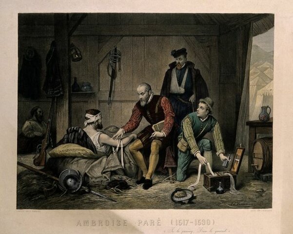 AMBROISE PARÉ (1517-1590)