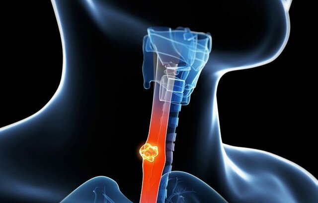 muerte de mi padre *