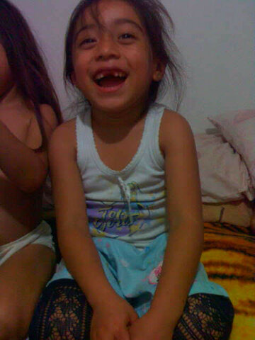 Caida de mis primeros dientes