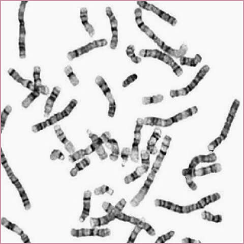 individualización de cromosomas mediante la tinción de bandas específicas (Zech, Casperson, Lubs, Drets y Shaw, Schnedl, Evans)