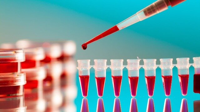 Test to differentiate differen types of blood is created.