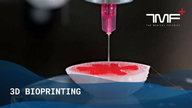 bioprinting