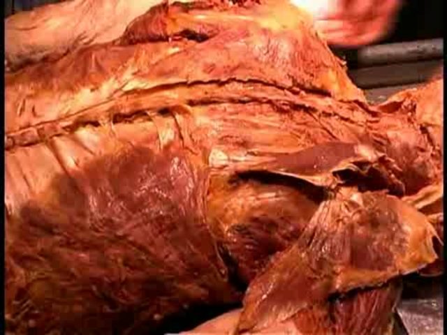 First dissections of human corpse