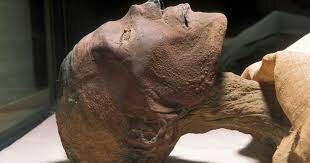 La primera muerte que causó la viruela: