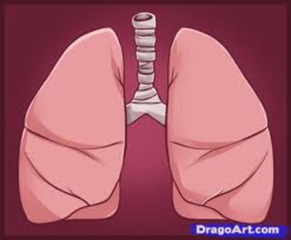 First double lung transplant