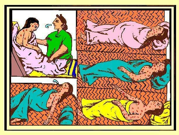 La viruela en Nueva España