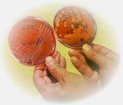 Robert Koch (Cultivos puros)