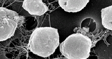 Genoma Methanococcus jannaschii