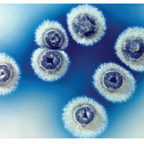 Streptomyces coelicolor