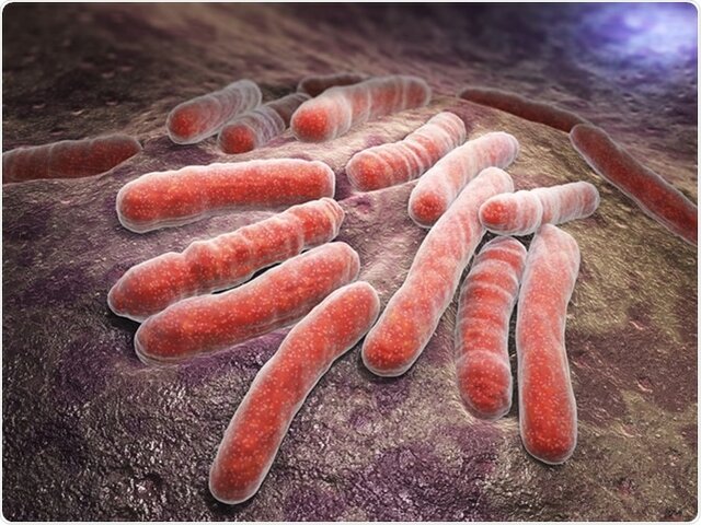 Tuberculose
