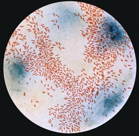 Haemophilus influenzae