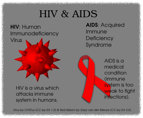 AIDS