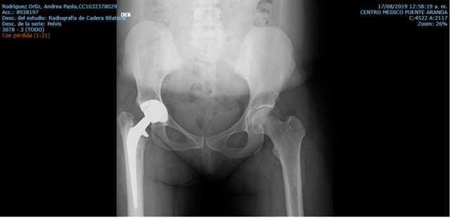 Intervención Quirúrgica