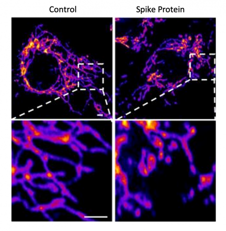 Salk Institute publishes study showing that spike proteins cause vascular disease.