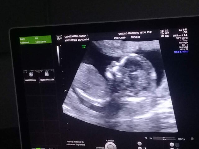 Me entere del Sexo de mi bebe