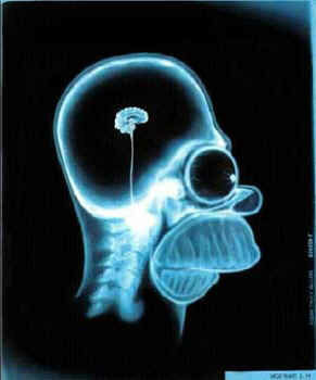 El cerebro