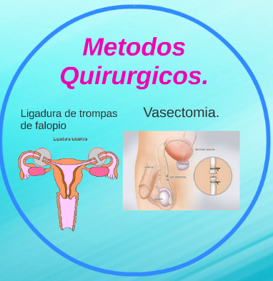 Ley 26.130 Anticoncepción Quirúrgica