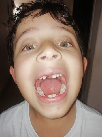 Se me cayo el mi primer diente