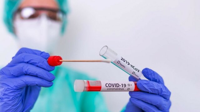 Las pruebas de COVID-19 también las realizará el IGSS