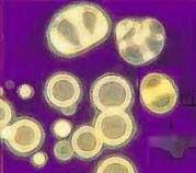 3200 millones de años PRIMERAS FORMAS DE VIDA COACERVADOS