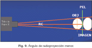 Técnica de Paralelismo