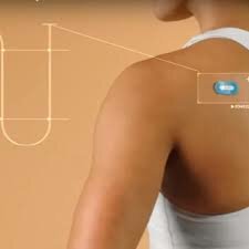 El primer sensor portátil de pH para la piel