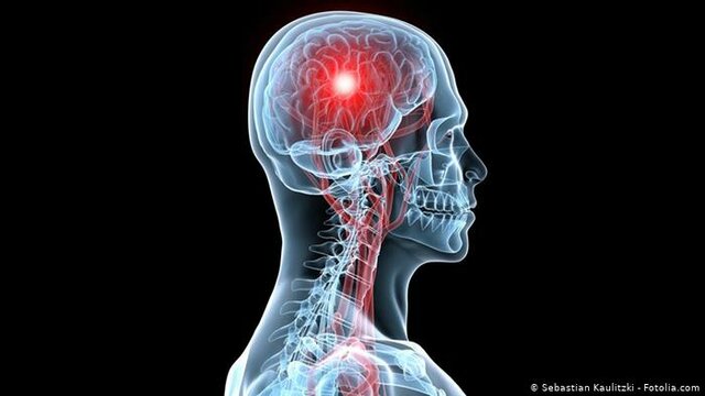 Joaquina sufre un ataque de apoplejía y se deteriora su salud