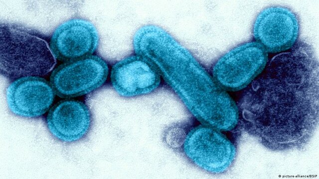 ΙΣΠΑΝΙΚΗ ΓΡΙΠΗ